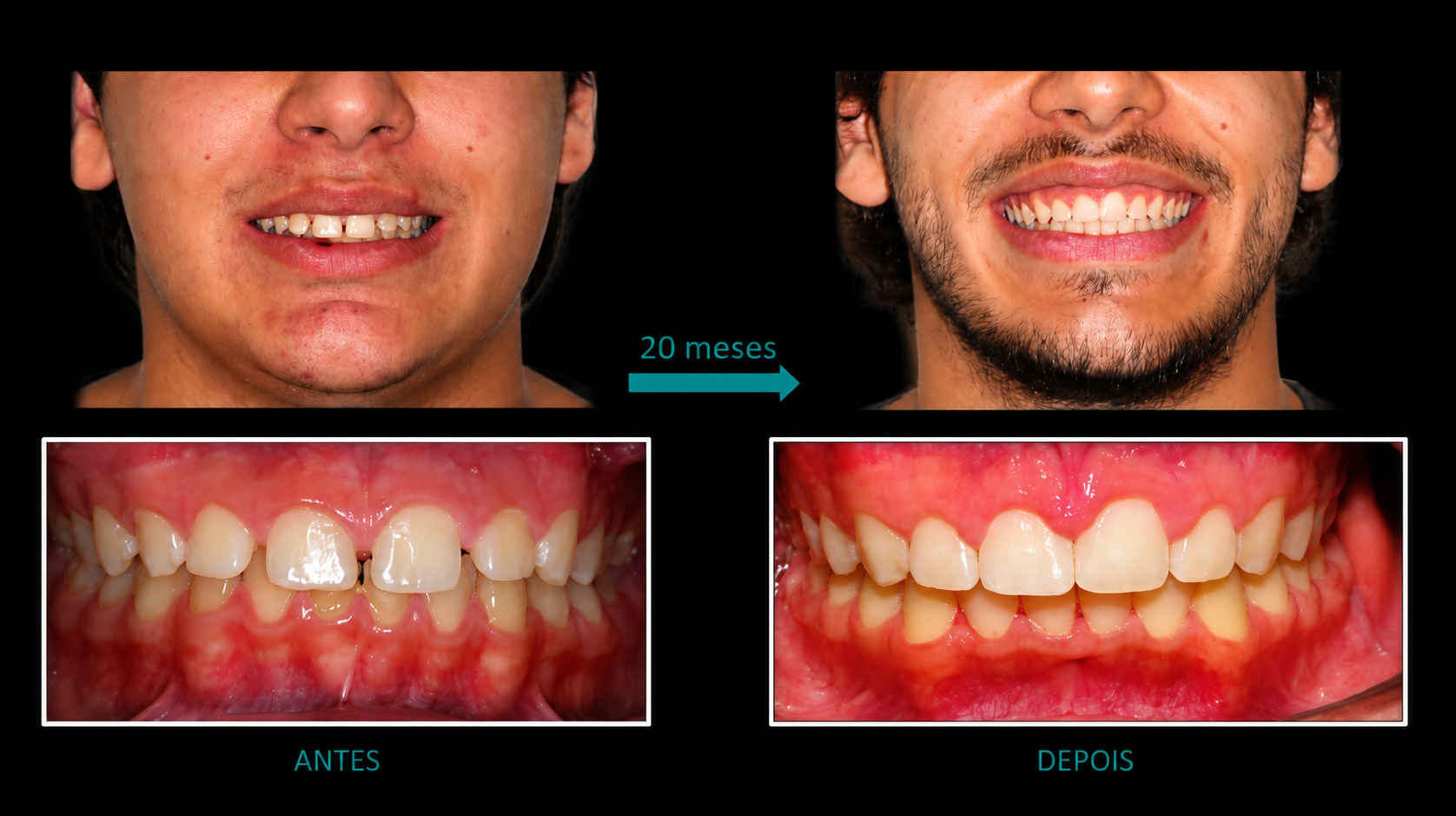 Consultorio dr fabio braga dentista aparelho 2