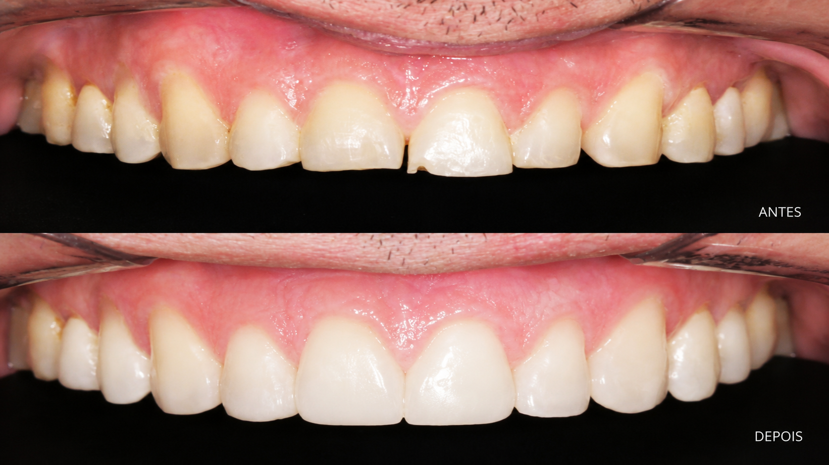 Consultorio dr fabio braga dentista aparelho