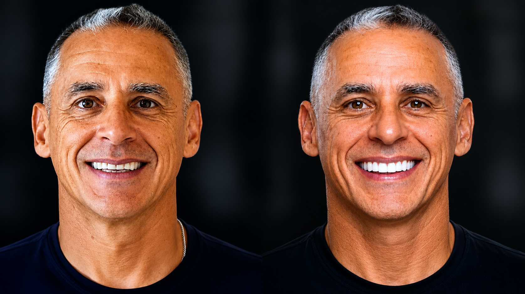 Consultorio dr fabio braga dentista lentes de porcelana